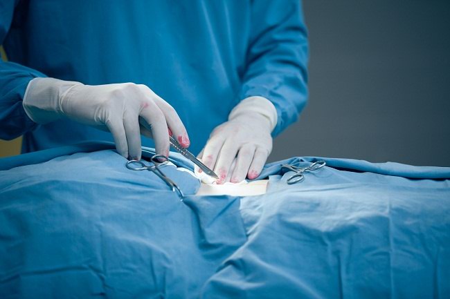 kenapa perlu histerektomi 0 alodokter